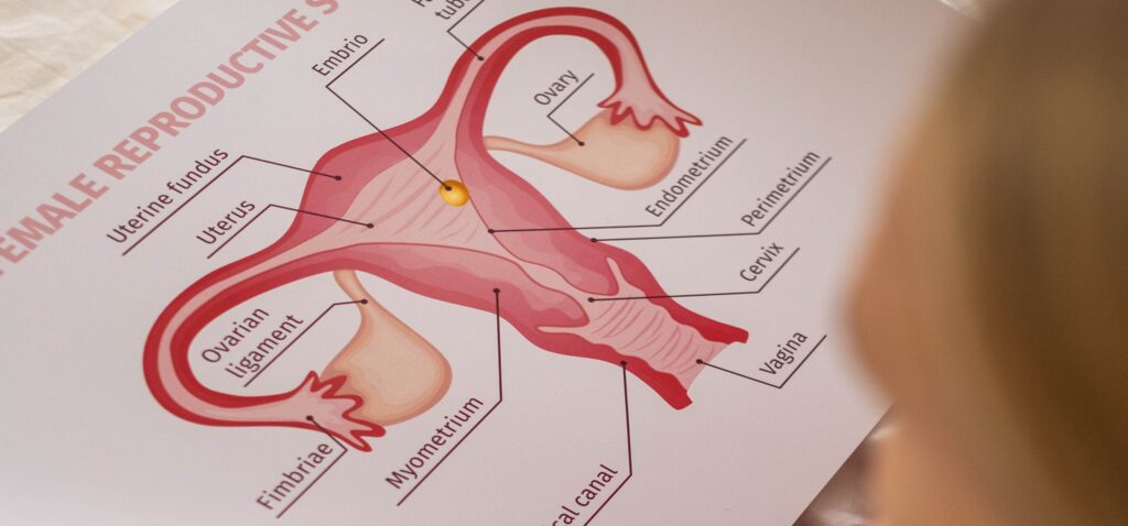 PCOS en hormonale disbalans hoe epigenetische en orthomoleculaire geneeskunde